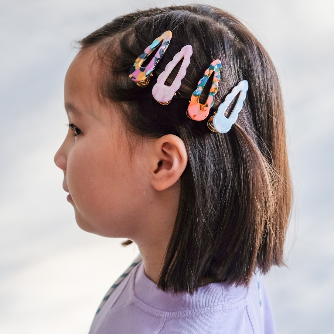 Scalloped Acetate Clips